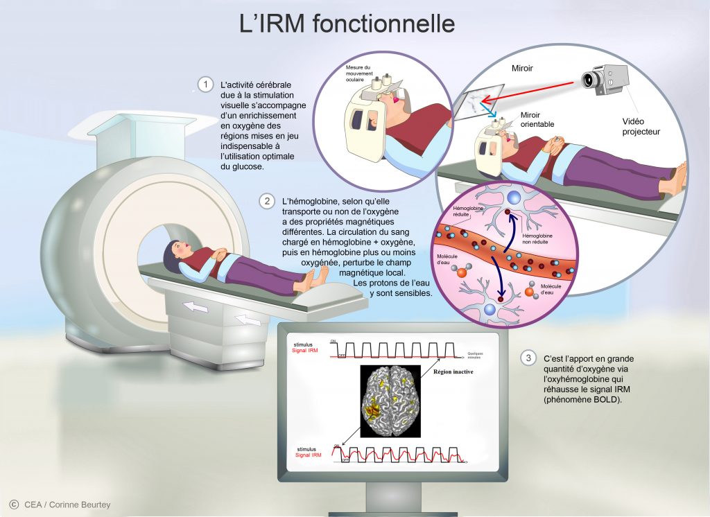 Principes De L IRM IRMf IRM De Diffusion Et TEP Vieterre principes-de-l-irm-irmf-irm-de-diffusion-et-tep-vieterre