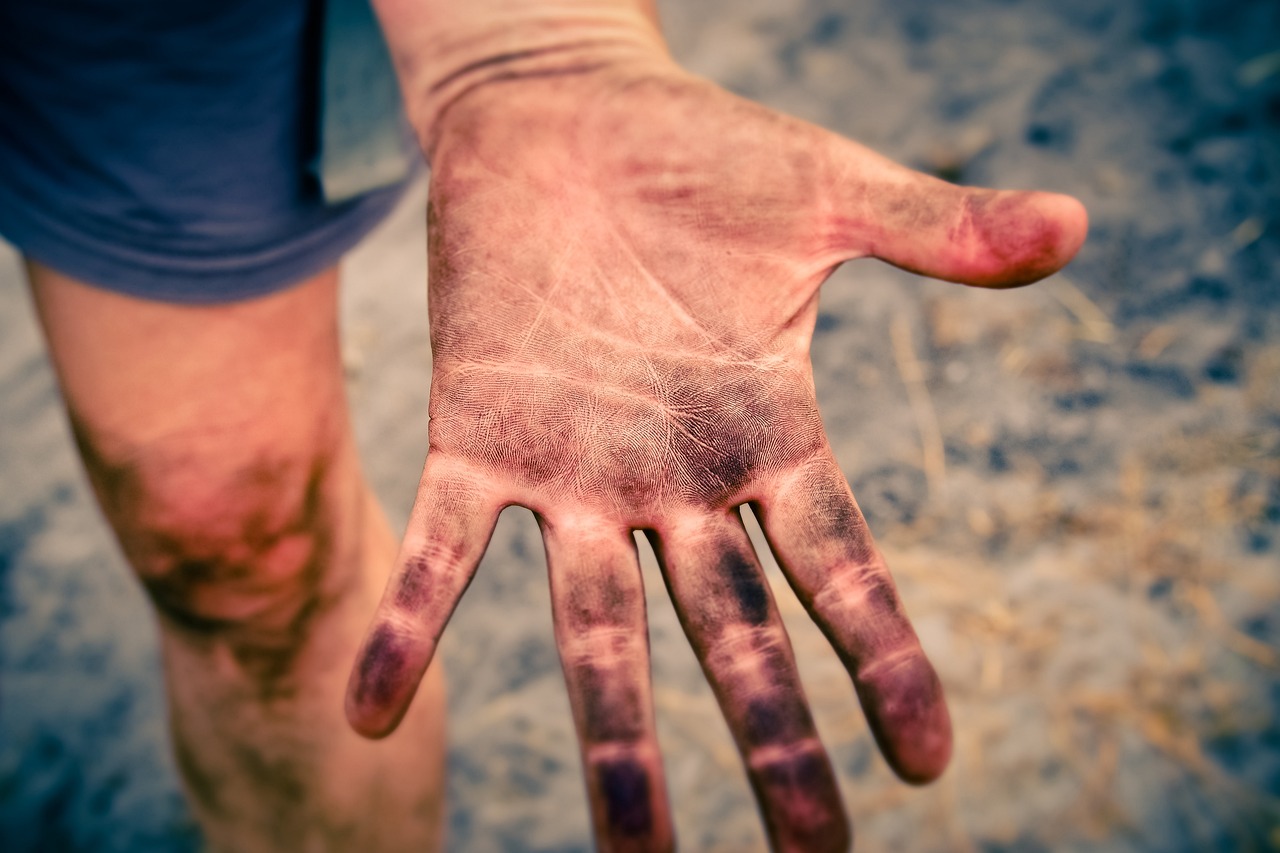 hand, palm, skin