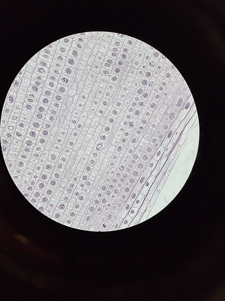 mitosis, biology, root tip, allium cepa, onion, prophase, metaphase, anaplasmosis, telephone, interphase, nucleus, chromosome, microscope, cells, stained, light microscope, microbiology, living, anaphase, telophase, mitosis, mitosis, mitosis, mitosis, mitosis, chromosome, chromosome, chromosome